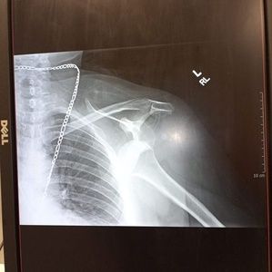 Meet your Posher, Eddie